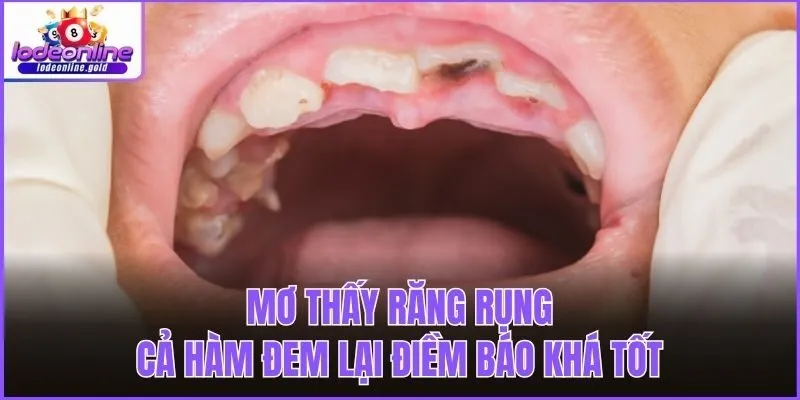 Mơ thấy răng rụng cả hàm đem lại điềm báo khá tốt