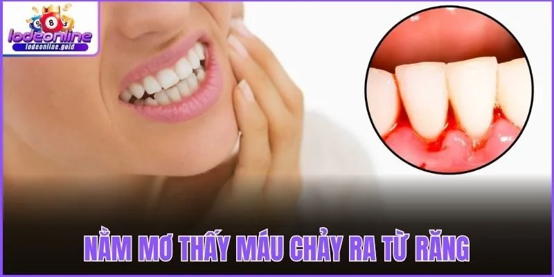 Nằm mơ thấy máu chảy ra từ răng